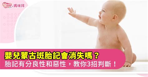 蒙古胎记|胎記？蒙古斑？如何觀察與判斷診治｜Mombaby 媽媽 